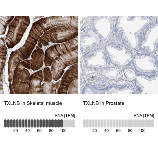 Anti-TXLNB