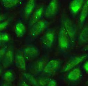 Anti-ACP5 / TRAcP