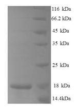 C-C motif chemokine 25 (Ccl25), partial, mouse, recombinant