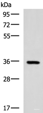 Anti-B3GAT1