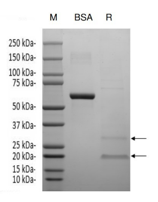 CLDN18.2, His, Human