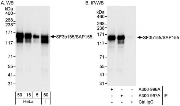 Anti-SF3b155/SAP155