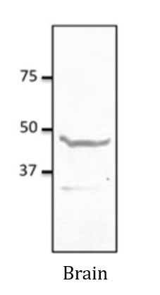 Anti-NPY1R
