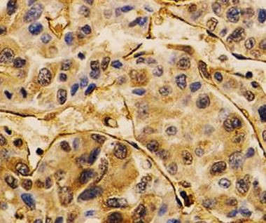 Anti-CD31