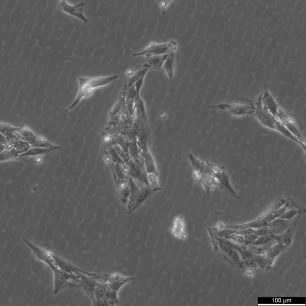 IBRS-2 Cells