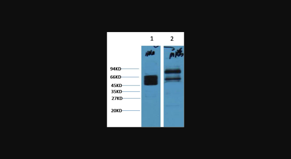 Anti-CK8, monoclonal
