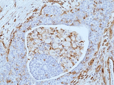 Anti-VISTA, Rabbit Monoclonal (RM503)