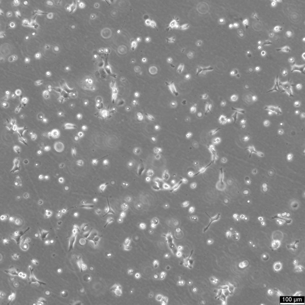 NCI-H1568 Cells