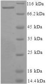 Xaa-Pro aminopeptidase 1 (XPNPEP1), human, recombinant