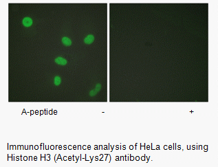 Anti-Histone H3 (Acetyl-Lys27)