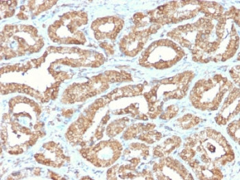 Anti-Ornithine Decarboxylase / ODC1, clone ODC1/2878R