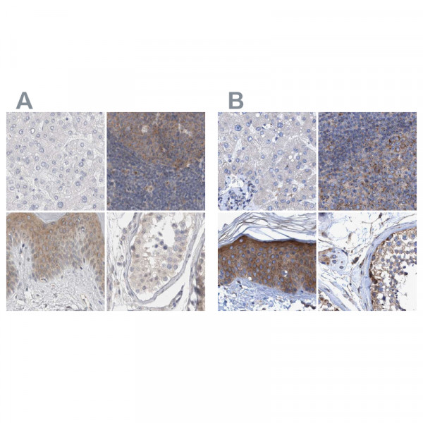 Anti-BICD2