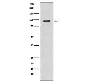 Anti-NBS1 / NBN (pS343), clone BGI-14