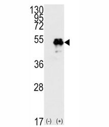 Anti-TP53 (p53)