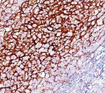 Anti-CD35, clone SPM554