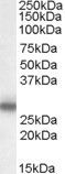 Anti-Myelin Protein zero, Internal