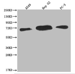Anti-USP22 Recombinant Monoclonal, clone 18H6