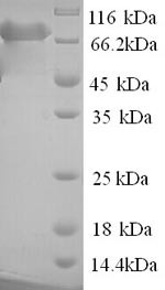 Poly (A)-specific ribonuclease PARN (PARN), human, recombinant