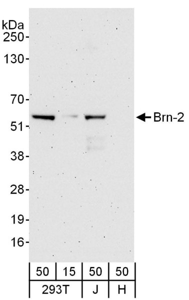 Anti-Brn-2