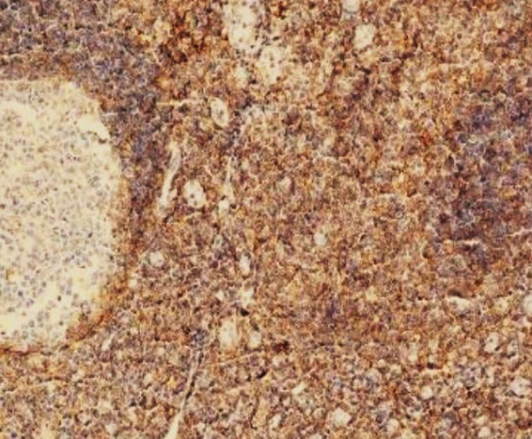 Anti-CD44, clone SQab20206