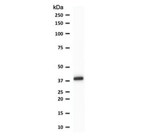 Anti-PU.1 / SPI1, clone TFPU1-1