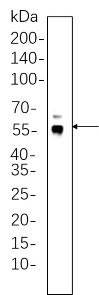 Anti-Recombinant ERG, clone 11A6