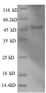 Actin-related protein 2/3 complex subunit 3 (ARPC3), partial, human, recombinant