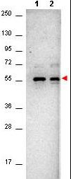 Anti-AKT, clone 18F10.E5