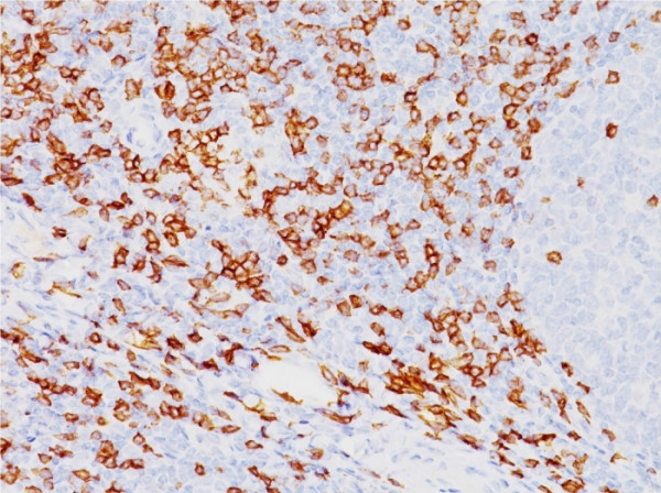 Anti-CD8a (Cytotoxic-&amp;Suppressor T-Cell Marker), clone SPM548