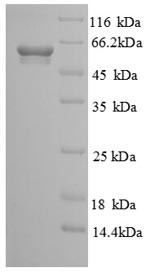 Soluble calcium-activated nucleotidase 1 (CANT1), partial, human, recombinant