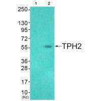 Anti-TPH2 (Ab-19)