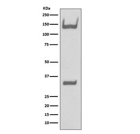 Anti-TrkA/TrkB/TrkC, clone HHH-14