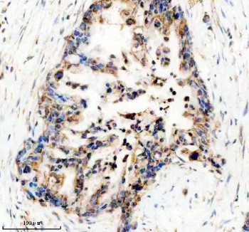 Anti-UBE2W / Ubiquitin-conjugating enzyme E2 W