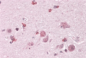 Anti-CHN2, C-terminal