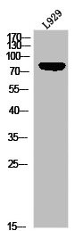 Anti-Phospho-LIPE (S855)