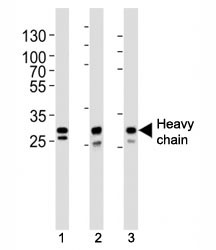 Anti-Cathepsin D (Heavy chain)