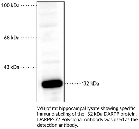 Anti-DARPP-32