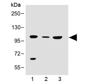 Anti-SLC14A2 (N-Terminal Region)