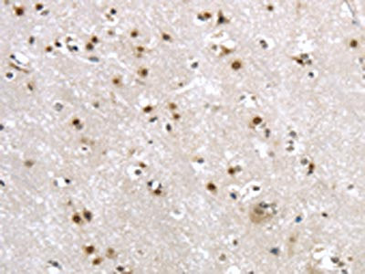 Anti-MRE11A