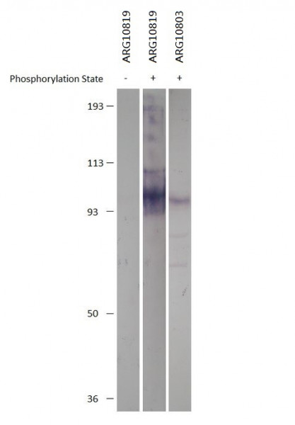 Anti-phospho-PDE4D (Ser190)