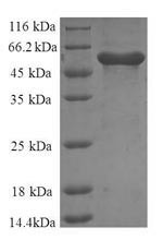 Annexin A6 (ANXA6), partial, human, recombinant
