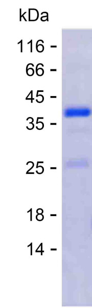 PARP1 (human), recombinant protein