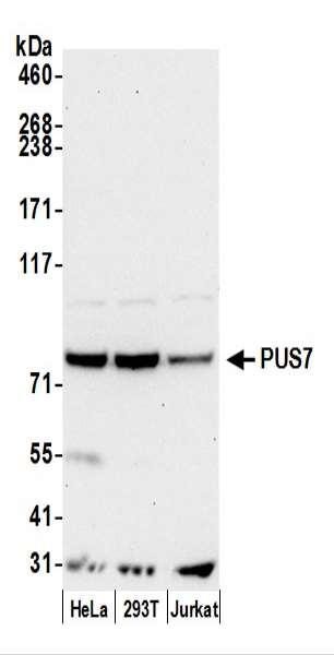 Anti-PUS7