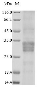 Oncostatin-M (Osm), rat, recombinant