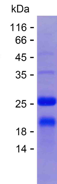 CALR (human), recombinant protein