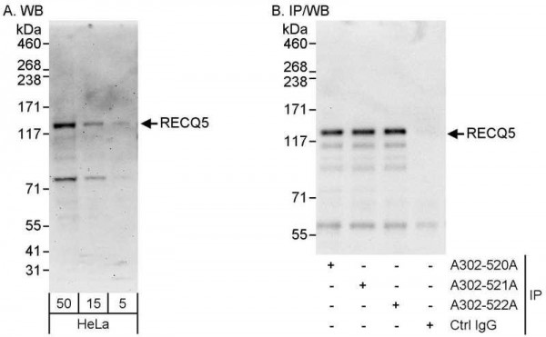 Anti-RECQ5