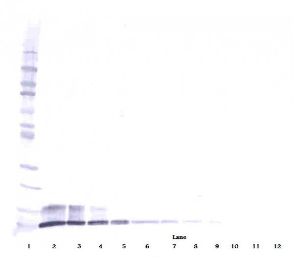 Anti-CXCL7 / NAP-2