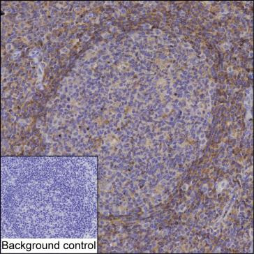 Anti-PKC-beta 1
