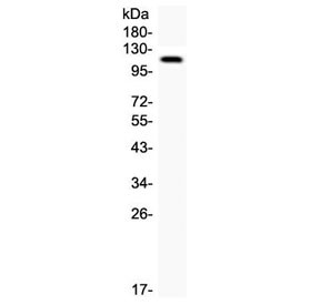 Anti-KIM-1 / TIM-1 / HAVCR1