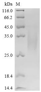 Parathyroid hormone/parathyroid hormone-related peptide receptor (PTH1R), partial, recombinant Pig